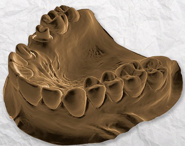 3D-CT-Scan-Image