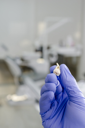 Tooth Extraction-image