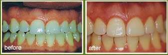 Cosmetic Dental Surgery Beverly Hills